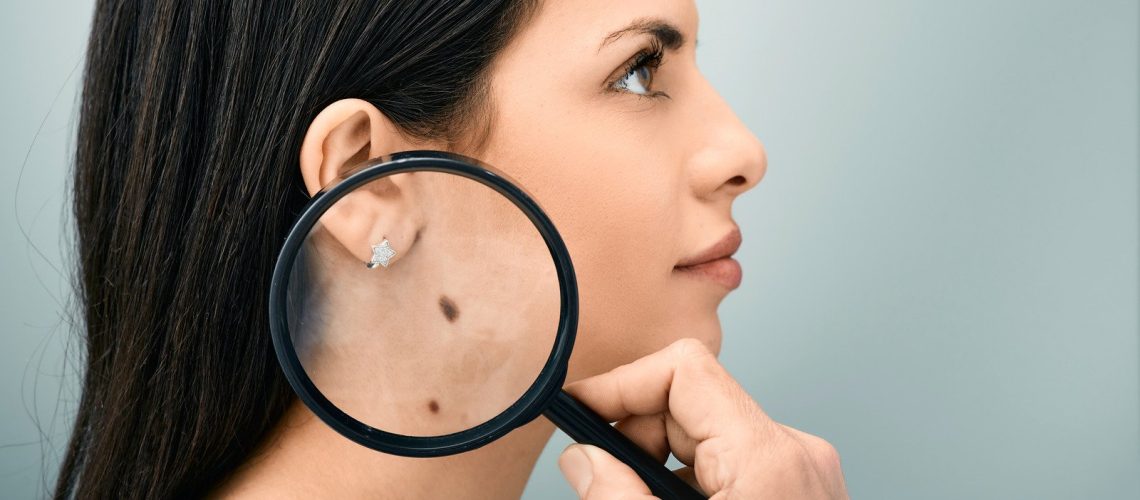 skin cancer, normal skin,